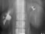 IVP Tomogram